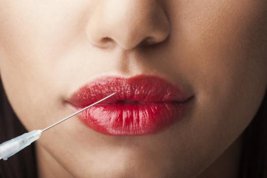 Woman receiving a lip filler injection